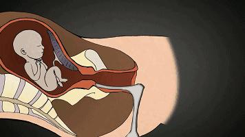 多次打胎真实案例,25岁女生接受多少次打胎