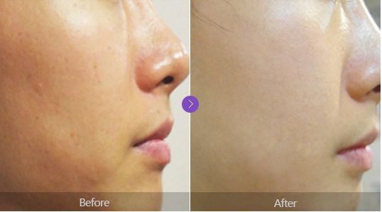 补水保湿滋润肌肤面膜10片装一盒,安瓶精华水润透亮睡眠面膜