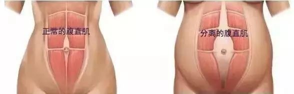 每天10分钟瘦肚子操,瘦腹操每天10分钟一个月效果