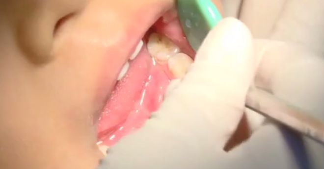 孩子乳牙掉了别扔，赶紧藏好，关键时刻能救急！