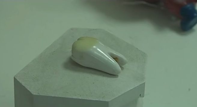 孩子乳牙掉了别扔，赶紧藏好，关键时刻能救急！
