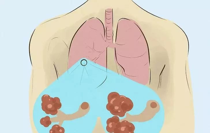 健康提醒发脾气易得8种病,老是烦躁易怒是什么病