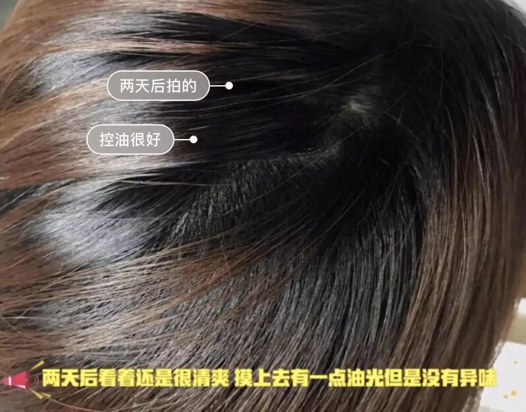 推荐一款真正的防脱发洗发水,推荐一款防脱发洗发水女士