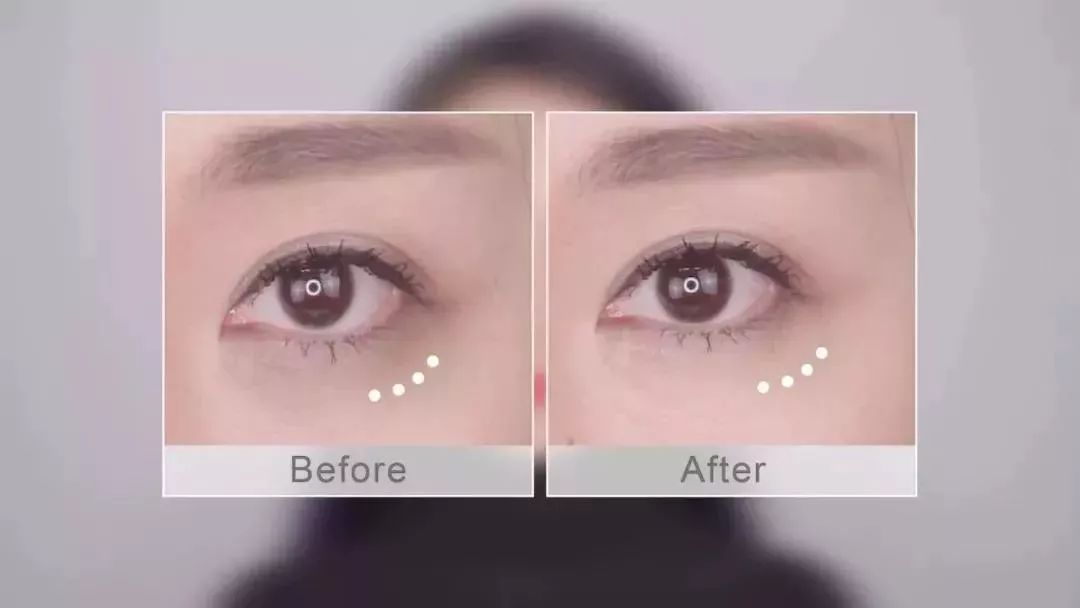 半个娱乐圈都用的面膜有多神奇,熬夜党必备的眼膜拯救你的黑眼圈