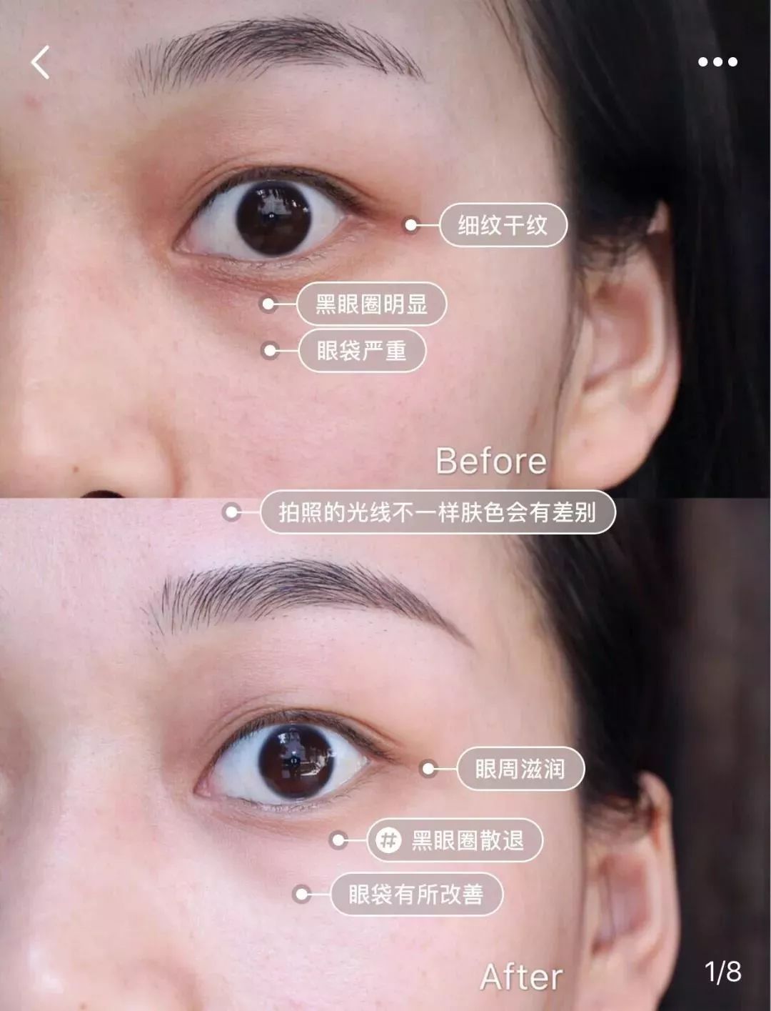 半个娱乐圈都用的面膜有多神奇,熬夜党必备的眼膜拯救你的黑眼圈