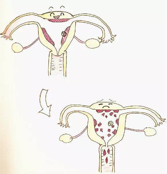 女子查出怀孕结果又来例假了,女子怀孕发现自己来例假