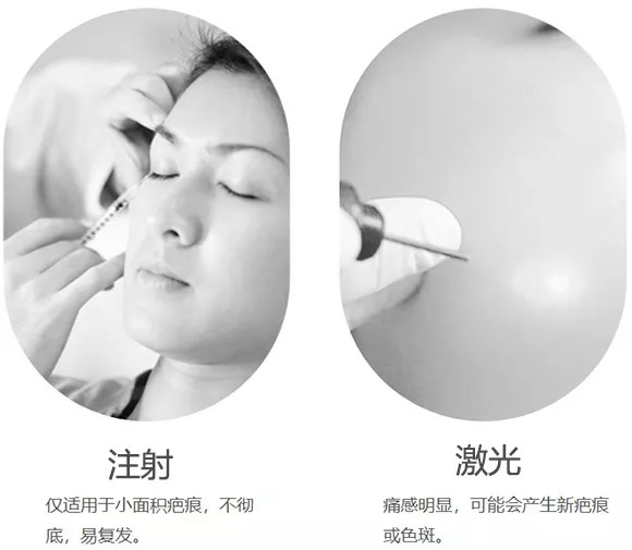 斑疤痘敏妊娠纹,伤痕印如何能快速消除