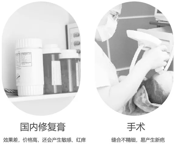 斑疤痘敏妊娠纹,伤痕印如何能快速消除