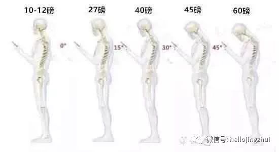 颈椎病压迫神经吃甲钴胺多长时间,颈椎病压迫神经微创手术要多少钱