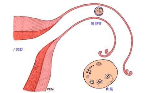 异位妊娠科普宣传图片,异位妊娠好发于哪个部位