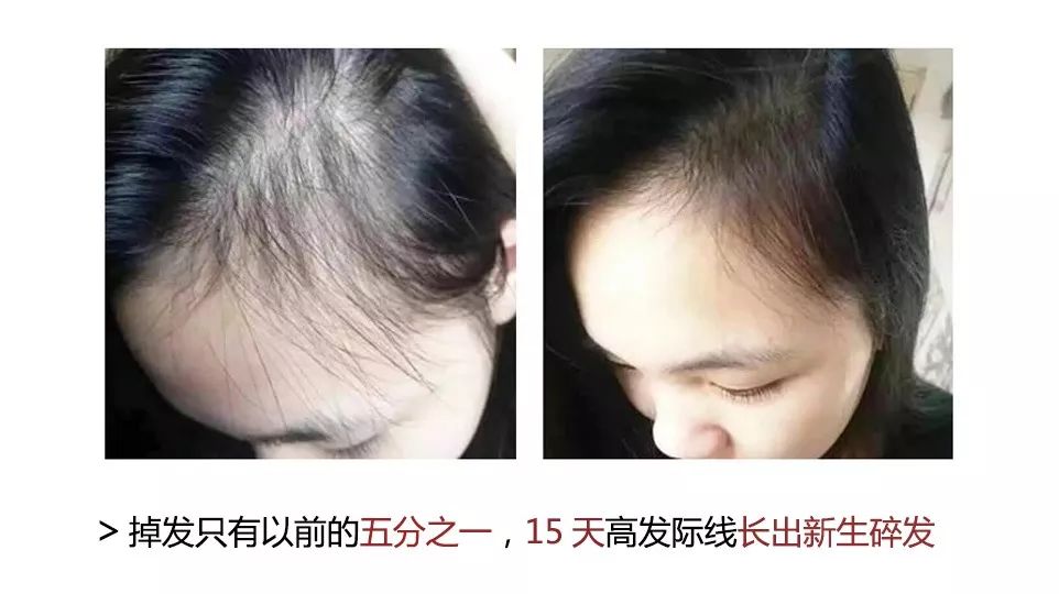 郭富城洗发水品牌,郭富城的头发用什么发蜡好