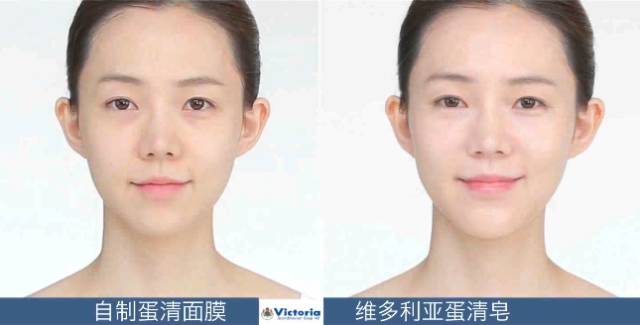 只听说蛋清能除皱，没想到瑞典皇室竟然用它来洗脸，还能去黑头！