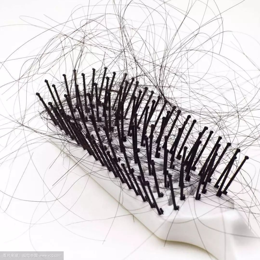 脱发的原因是什么呢,脱发的原因和治疗方法男