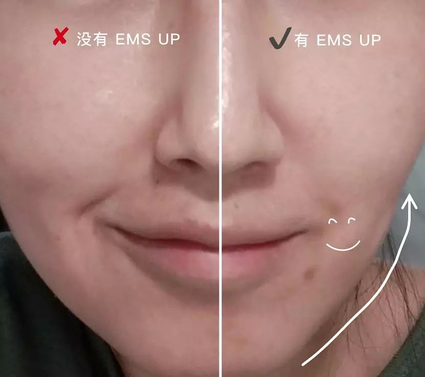 敏感肌哪一款美容仪是最好的,改善肤质选哪款美容仪