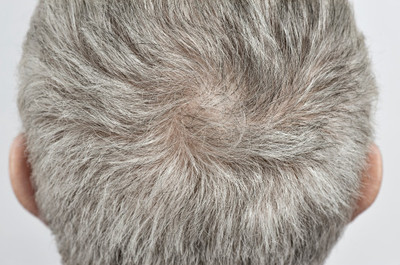 多情应笑我，早生华发-为80后白发干部支招