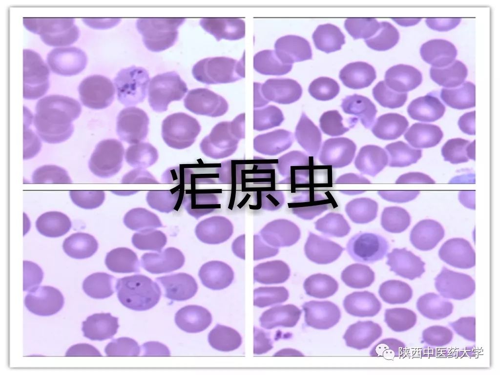 毒液的视角看毒液,医学生眼中的饮料图片