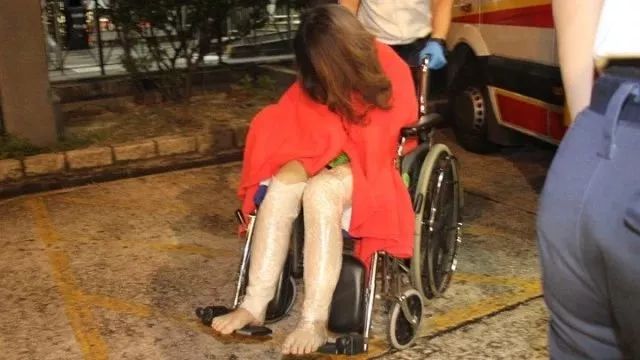 过生日被烫伤意味着什么,大学生吃火锅被烧伤