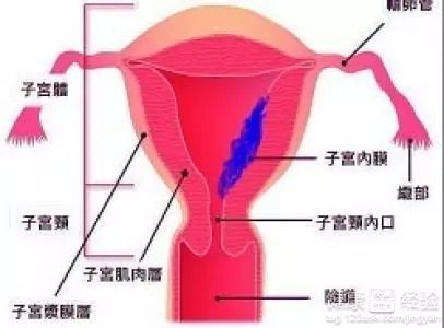 已经停经几年了又出血怎么回事,停经一年左右又有少量出血