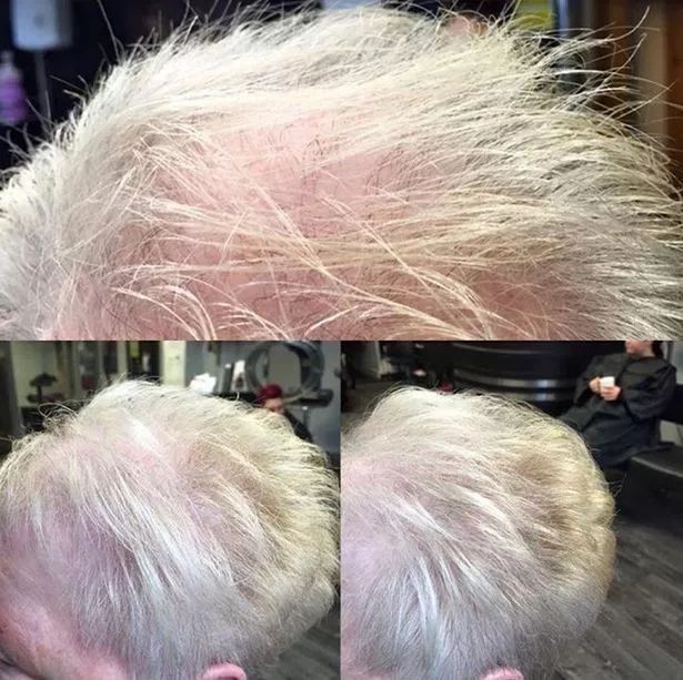 防脱而且还生发的洗发水,一款可以从根本改善发质的洗发水