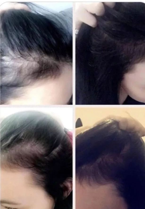 防脱而且还生发的洗发水,一款可以从根本改善发质的洗发水