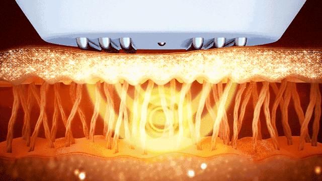 躺着减肥瘦肚子神器,能瘦肚子的瘦身贴