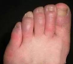 足底暖宝宝暖身贴,冬天必备神器暖宝宝贴