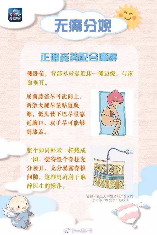 准妈妈分娩关注事项,哪些医院提供无痛分娩