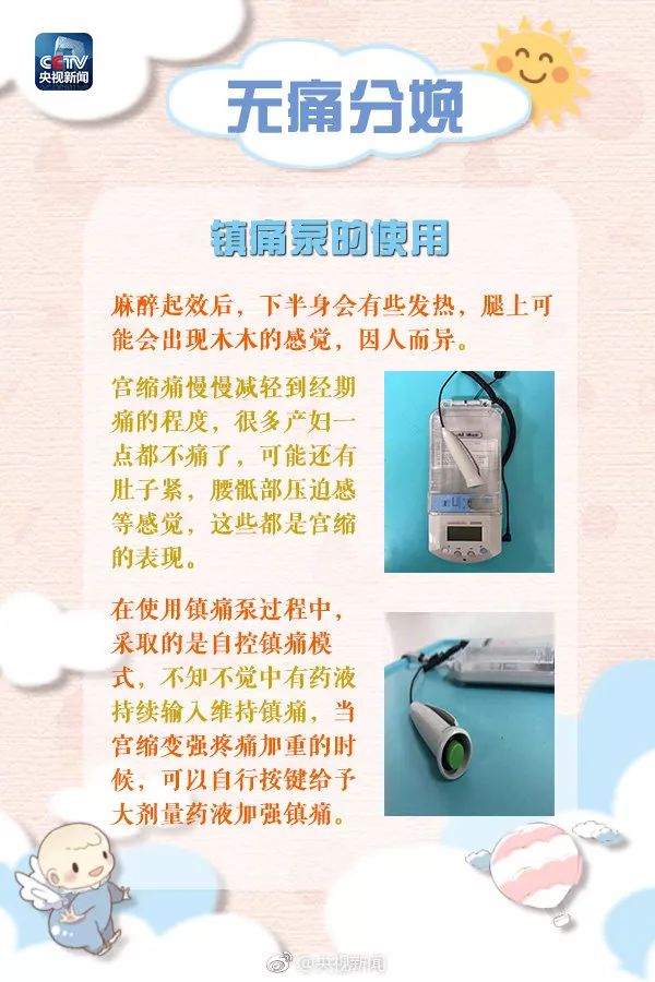 准妈妈分娩关注事项,哪些医院提供无痛分娩