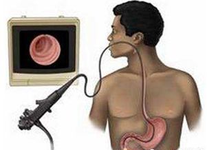 这例胃早癌的发现，内镜医师功不可没！