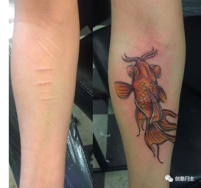 去除纹身疤痕最好的方法,疤痕纹身怎么去除