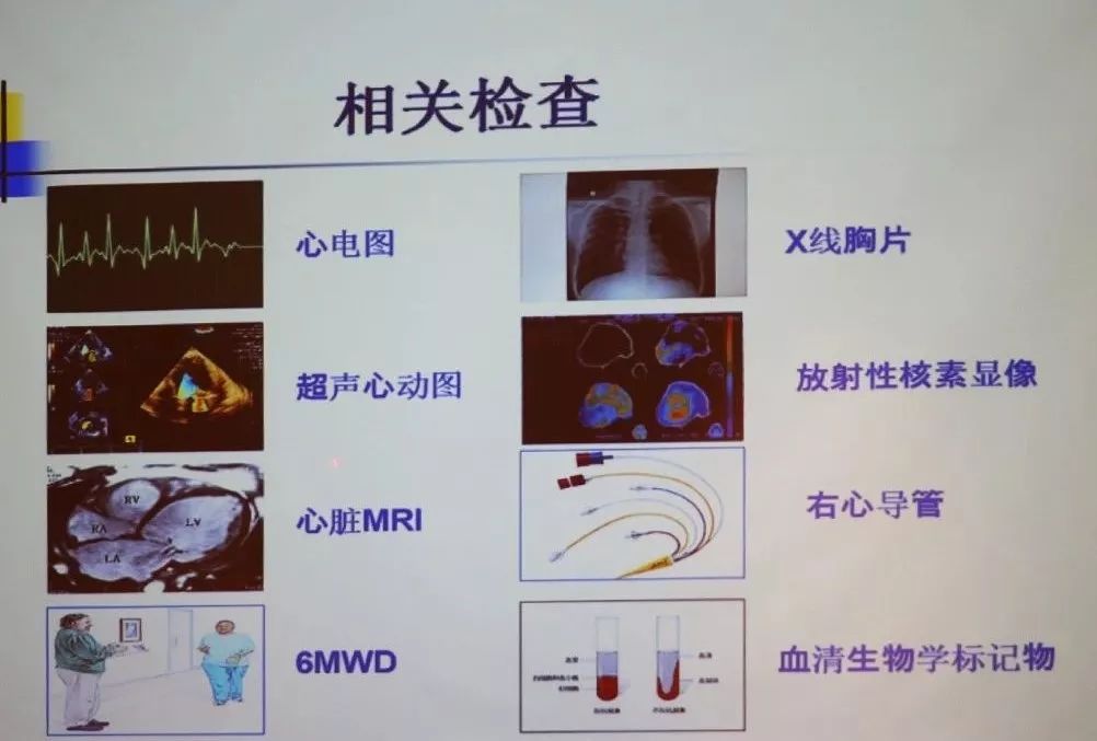 肺心病右心衰竭怎么办,肺心病心衰晚期如何治疗