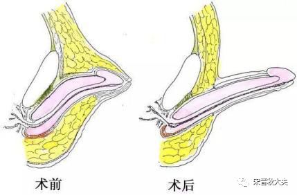「热点」男孩子“下面”小不小？