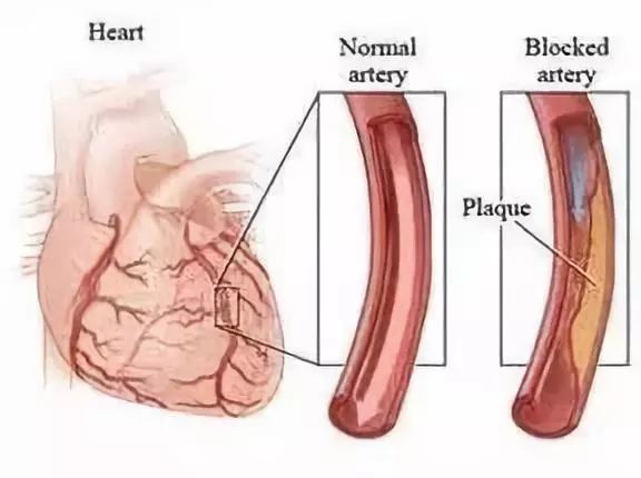 什么中药泡水喝对血汗管有好处,三种中草药泡水治疗冠心病