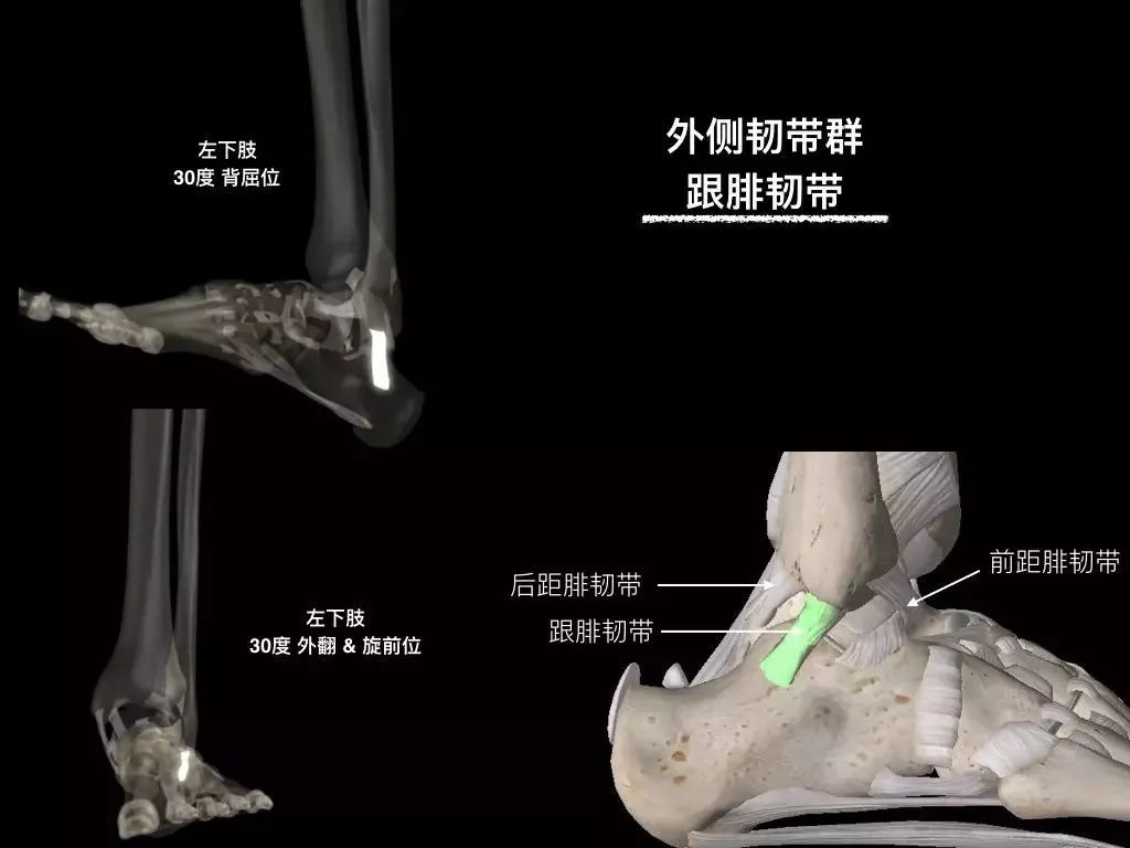 踝关节韧带核磁断层解剖图,踝关节外侧副韧带的功能解剖
