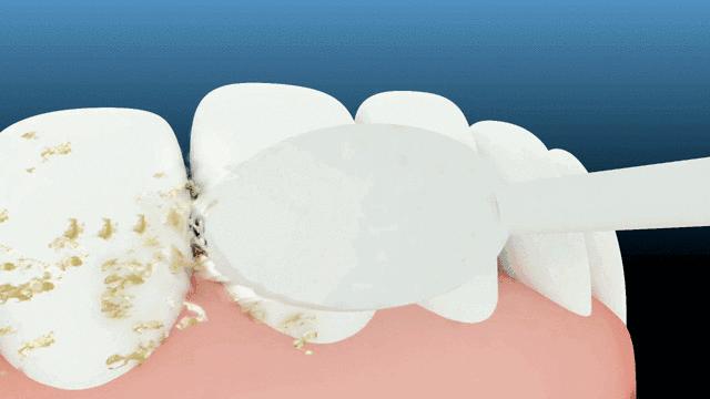 便宜哭了！日本人都在用的变态牙刷，竟然比洗牙还白，牙垢、牙龈出血全解决，嘴巴里脏东西洗出来后，太清爽了