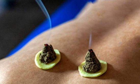 冬季养阴润燥,女性冬季怎么滋阴补肾