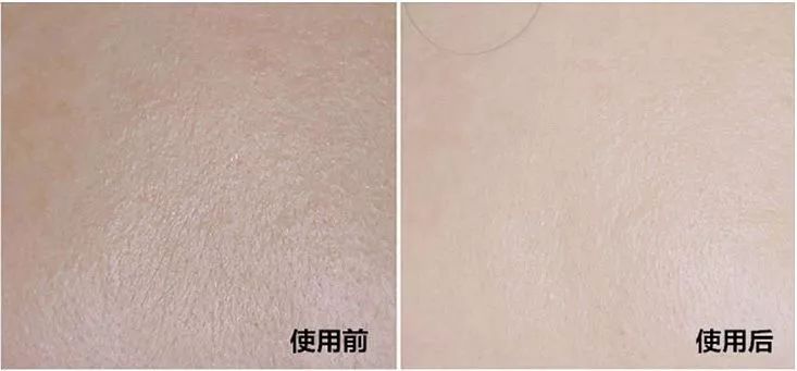 燕窝玻尿酸童颜面膜,玻尿酸燕窝面膜