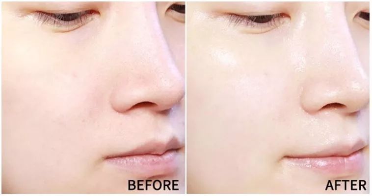 燕窝玻尿酸童颜面膜,玻尿酸燕窝面膜