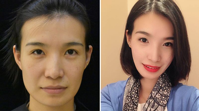 你的法令纹怎么去,你的法令纹越来越浅