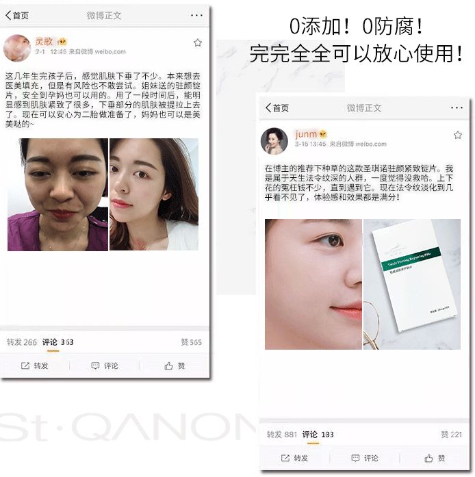 你的法令纹怎么去,你的法令纹越来越浅