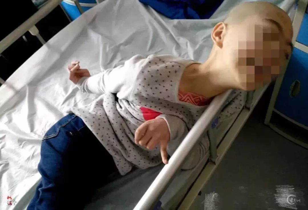 女孩误喝妈妈的中药中毒,女孩误喝妈妈一杯水中毒