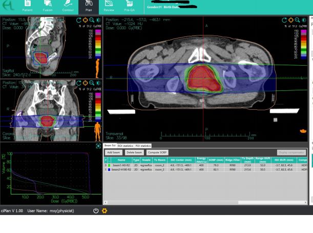 武威重离子中心放疗一科,甘肃武威市医院放疗科