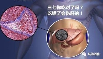医生报道三七伤肝是真的吗,三七伤肝还是护肝