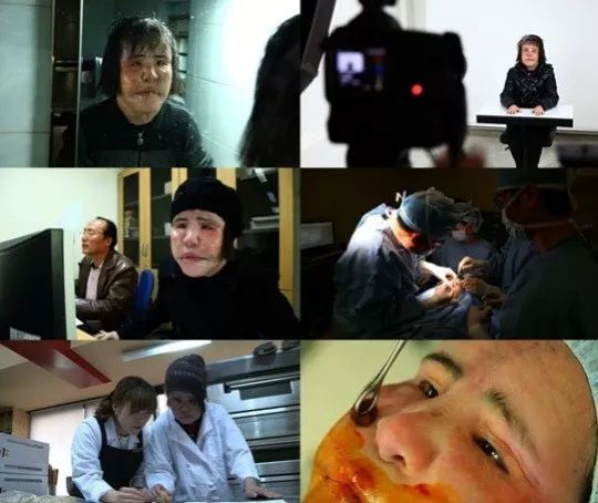 韩国整容毁容女逝去,整容电风扇大妈