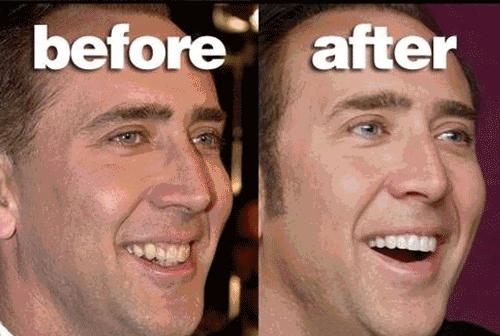 牙科牙齿美白全过程,牙齿黄又臭又烂牙怎么办