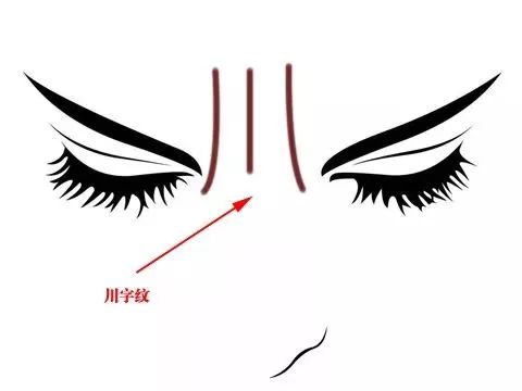 眉间纹抬头纹祛皱效果好吗,祛皱淡纹美容院