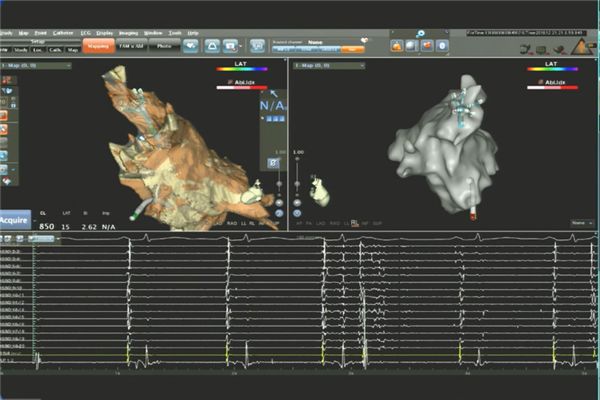 「房颤专项能力培训第19期」天津医大总医院站，连续3天课程，圆满收官！