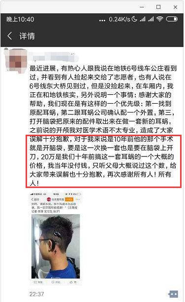 人工耳蜗丢失辟谣,人工耳蜗丢失真实事件