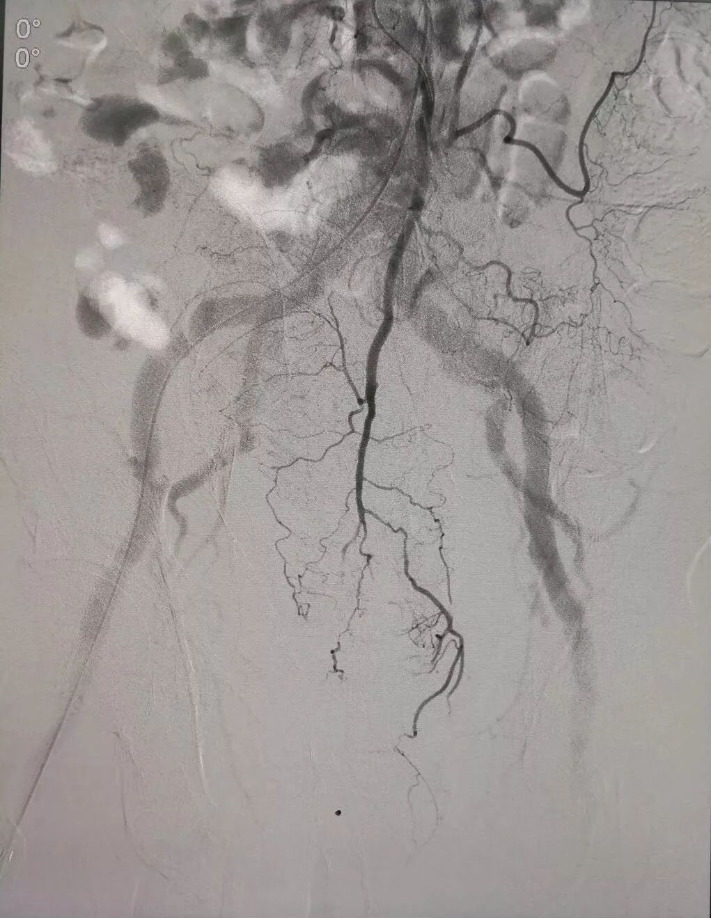 运城第一医院肿瘤介入科专家,运城市第一医院介入科专家