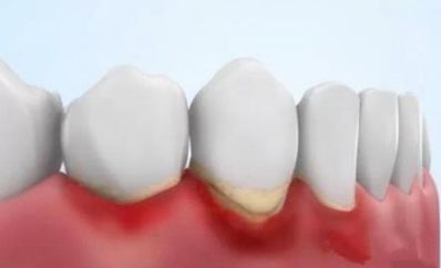 韩国钻石美白牙齿的牙膏好用吗,韩国牙膏排名第一名儿童